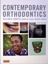 Image of Contemporary Orthodontics 5 Edition